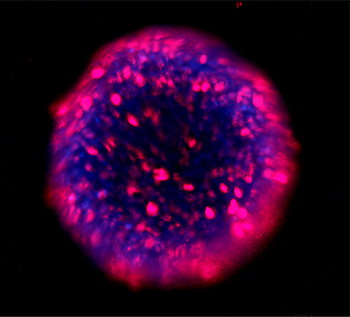 tubulin-tracker-deep-red tubulin-tracker-deep-red