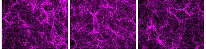 Figure 5. Live rat cortical neurons labeled with Tubulin Tracker Deep Red. 3-images-neurons-stained-tubulin-tracker-deep-red-probe