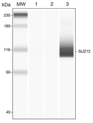 Figure 1. Immunoprecipitation of SUZ12 in K562 cells. western-blot-showing-specific-detection-immunoprecipitated-proteins