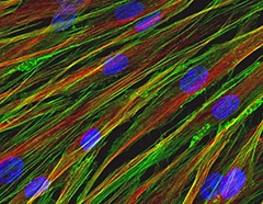 Multicolor staining of human fibroblasts Multicolor staining of human fibroblasts