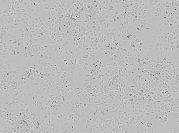 转染前培养物中 A549 细胞的明场图像 转染前培养物中 A549 细胞的明场图像