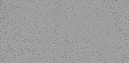 Calu-3 Cells Using Lipofectamine 3000 Reagent Calu-3 Cells Using Lipofectamine 3000 Reagent