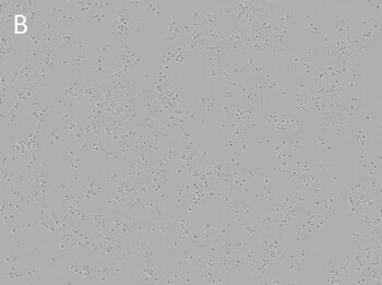 Posttransfection analysis of D17 cells bright-field Posttransfection analysis of D17 cells bright-field