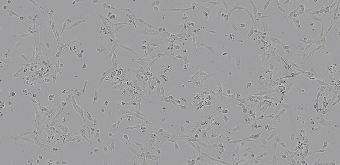 Brightfield image of GCT cells in culture, prior to transfection Brightfield image of GCT cells in culture, prior to transfection
