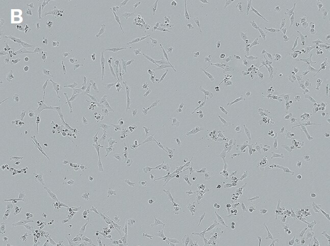 bright-field image demonstrating 32% transfection efficiency bright-field image demonstrating 32% transfection efficiency