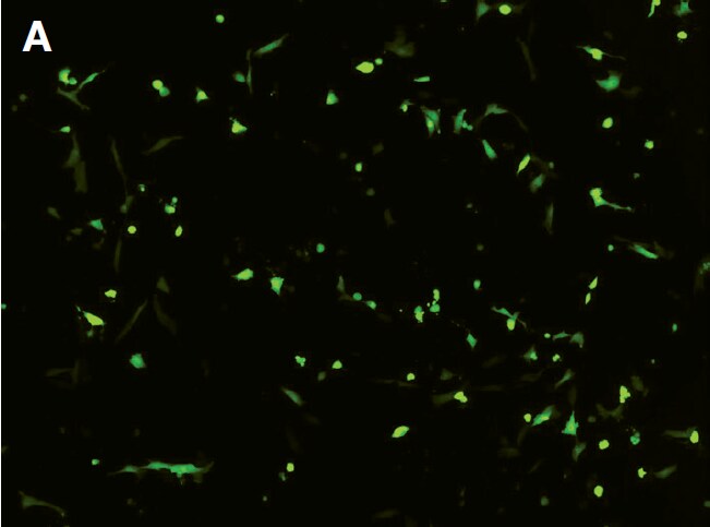 Fluorescence image demonstrating 32% transfection efficiency Fluorescence image demonstrating 32% transfection efficiency