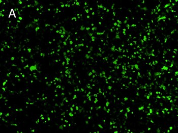 Posttransfection analysis of hepa 16 fluorescence cells Posttransfection analysis of hepa 16 fluorescence cells