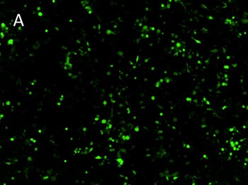 Posttransfection analysis of LLC1 cells fluorescence Posttransfection analysis of LLC1 cells fluorescence