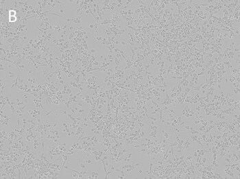 Posttransfection analysis of LLC1 cells bright-field images Posttransfection analysis of LLC1 cells bright-field images