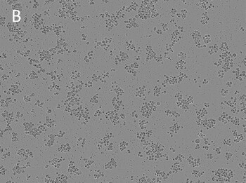 Posttransfection analysis MDAMB453 of bright-field cells Posttransfection analysis MDAMB453 of bright-field cells