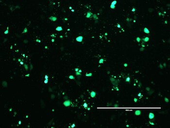 Posttransfection analysis of MDA-MB-468 cells Posttransfection analysis of MDA-MB-468 cells