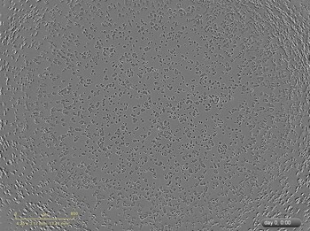 转染前培养物中 MDAMB468 细胞的明场图像。 转染前培养物中 MDAMB468 细胞的明场图像。