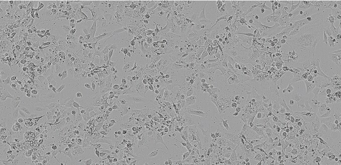 Brightfield image of NCI-H1975 cells in culture, prior to transfection. Brightfield image of NCI-H1975 cells in culture, prior to transfection.