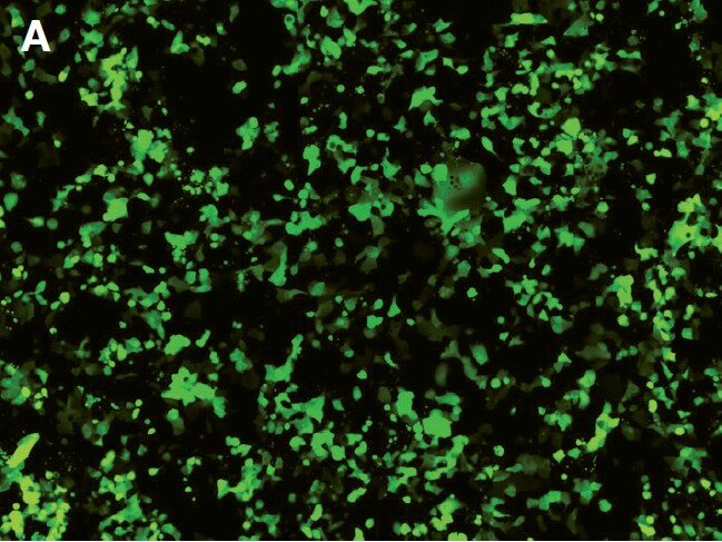 Fluorescence images demonstrating 49% transfection efficiency Fluorescence images demonstrating 49% transfection efficiency