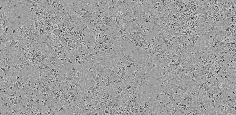 Brightfield image of NCI-H441 cells in culture, prior to transfection Brightfield image of NCI-H441 cells in culture, prior to transfection