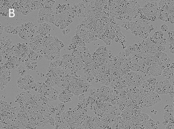 Posttransfection analysis of NCIH460 bright-field cells Posttransfection analysis of NCIH460 bright-field cells