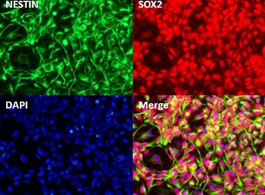 stained_with_DAPI_(blue) stained_with_DAPI_(blue)