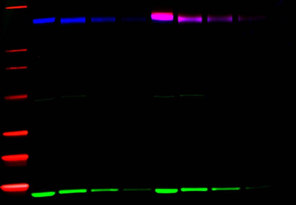 Western blot Western blot