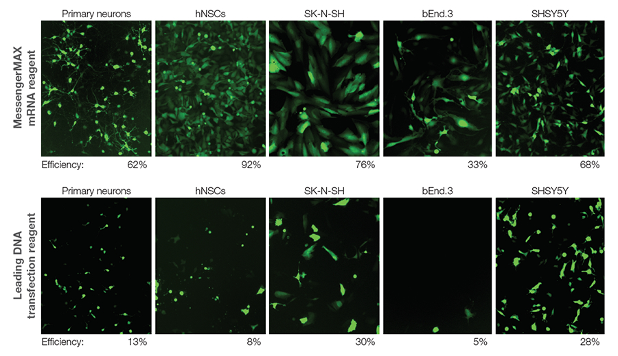 Neurobiology Transfection Guide | Thermo Fisher Scientific - EE