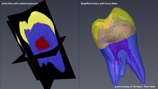 Molar Segmentation Using Watershed, Top-Hat, and Surface Generation