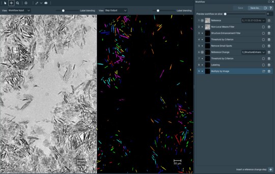 Segmentation of Pathological Osteocytes in an Undecalcified Piece of Mouse Bone using Amira-Avizo2D