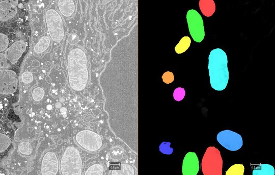 FIBSEM Mitochondria Segmentation