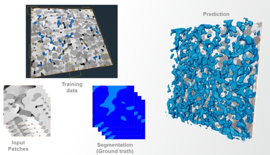 Patch Extraction Tools for Deep Learning Data Preparation
