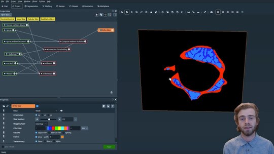How to Perform Trabecular and Cortical Bone Segmentation
