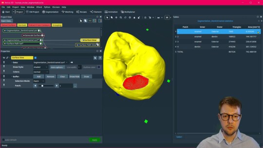 How to Calculate Surface Area of a Custom ROI