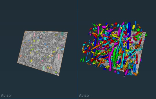 Deploy ROI Extractor and Patch Extractor Modules