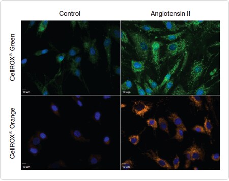 bioprobes-68.par.56493.image.450.355.1.dat-detection-ros-gif bioprobes-68.par.56493.image.450.355.1.dat-detection-ros-gif