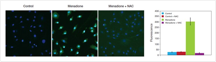 bioprobes-68.par.21896.image.740.213.1.dat-detection-ros-high-content-gif bioprobes-68.par.21896.image.740.213.1.dat-detection-ros-high-content-gif