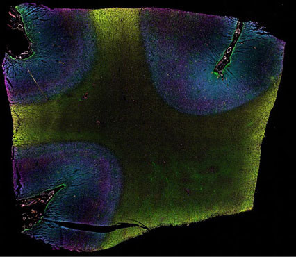 Stained human brain tissue using ReadyLabel Antibody Labeling Kits Fluorescent microscopy image of human brain tissue