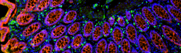 Epitope Tag Antibodies Four color tissue staining by fluorescent immunohistochemistry with cell localization identified via protein target.