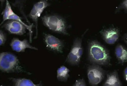 Live cell labeling Cells stained with Cell Tracker in white plus green mitochondria, red Golgi, and blue nucleus