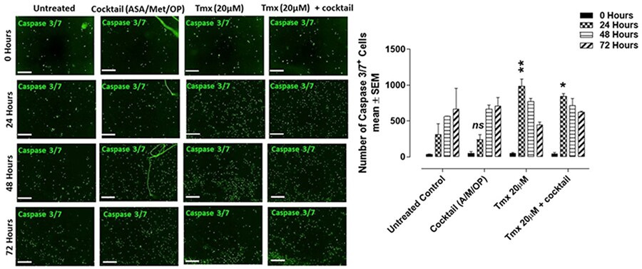 Cells stained with CellEvent Caspase 3/7 Green and imaged with Incucyte® ZOOM Live-Cell Analysis Cells stained with CellEvent Caspase 3/7 Green as indicated with apoptotic cells being bright green and live cells being dark, and imaged with Incucyte® ZOOM Live-Cell Analysis