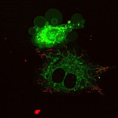 Catastrophic blebbing of the cell membrane Catastrophic blebbing of the cell membrane