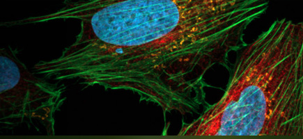 fluorescent cells fluorescent cells mounted with prolong antifade