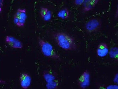 multicolor microscopy image overlay of cells stained with pink prohibitin, green catenin, and blue nuclei