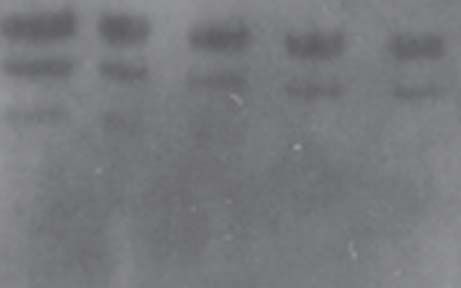 tb8 Western blot troubleshooting, high background
