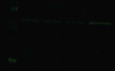 tb11 Fluorescent western blot troubleshooting, weak or no signal
