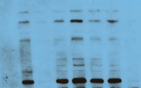 tb6 Western blot troubleshooting, nonspecific bands