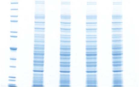 tb5 Protein electrophoresis troubleshooting, shadow at lane edges