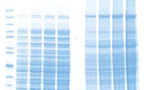 tb1 Electrophoresis troubleshooting- bands lose resolution, are not straight
