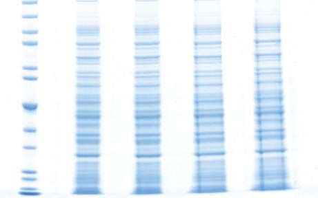 tb2 Protein electrophoresis troubleshooting, streaks at lane edges, dumbbell shaped bands