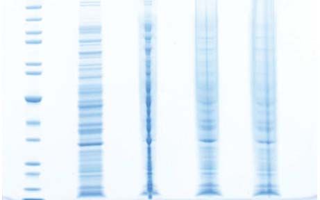 tb3 Protein electrophoresis troubleshooting, narrowing lanes, undefined bands
