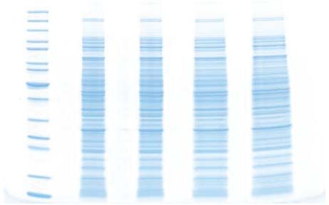 tb4 Protein electrophoresis troubleshooting, lane widening