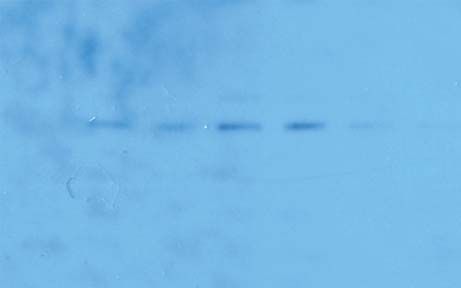 tb9 Western blot troubleshooting, weak or no signal