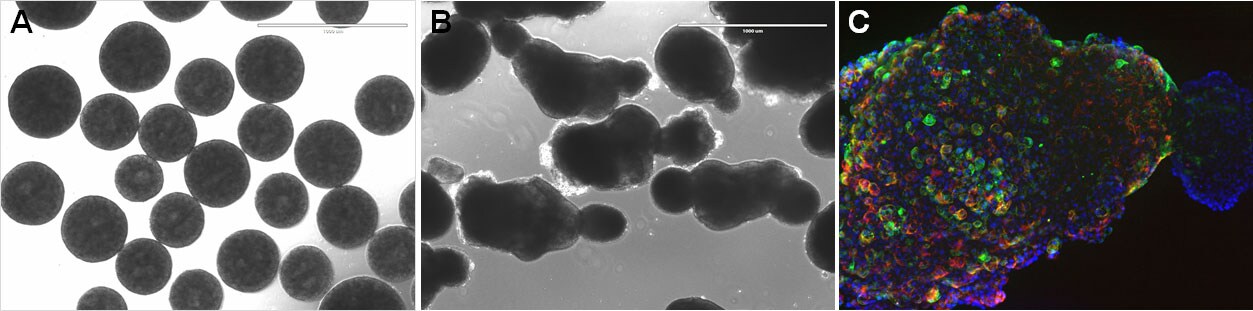 Cardiomycytes differentiated in suspension from PSC spheroids grown in StemScale medium Cardiomycytes differentiated in suspension from PSC spheroids grown in StemScale medium