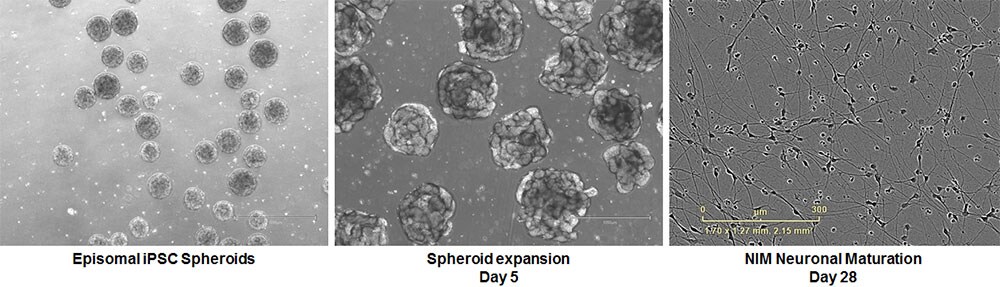 Neural induction of spheroids Neural induction of spheroids